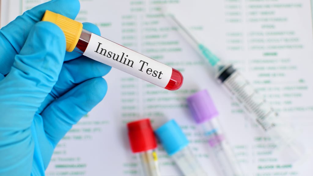 insulineresistentie testen