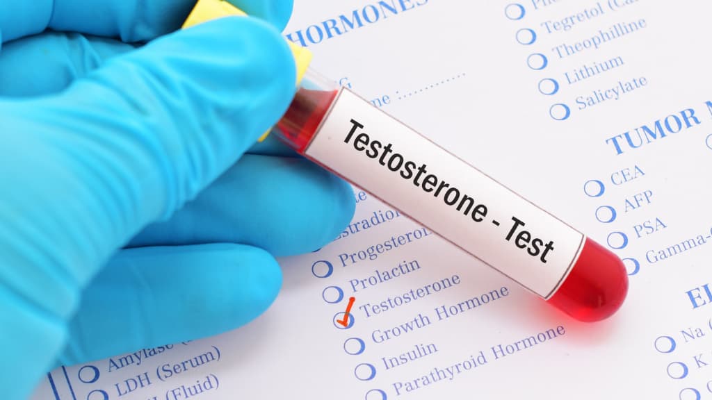Je testosteron verhogen op een natuurlijke manier: 10 inzichten